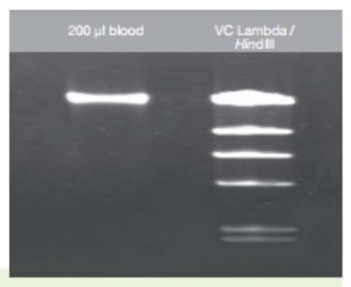 [VIV-GF-BD-100] kit de purificacion de dna 100pbas. vivantis