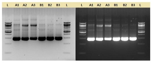[VIV-PL5202] pfu dna polimerasa(pyrococcus furiosus) 5u/ul, 500u. vivantis
