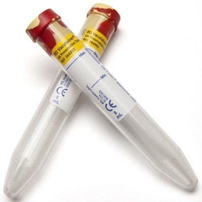 tubo cónico sin conservador microbiológico, 16x100mm, 8.0ml, para recolección de orina